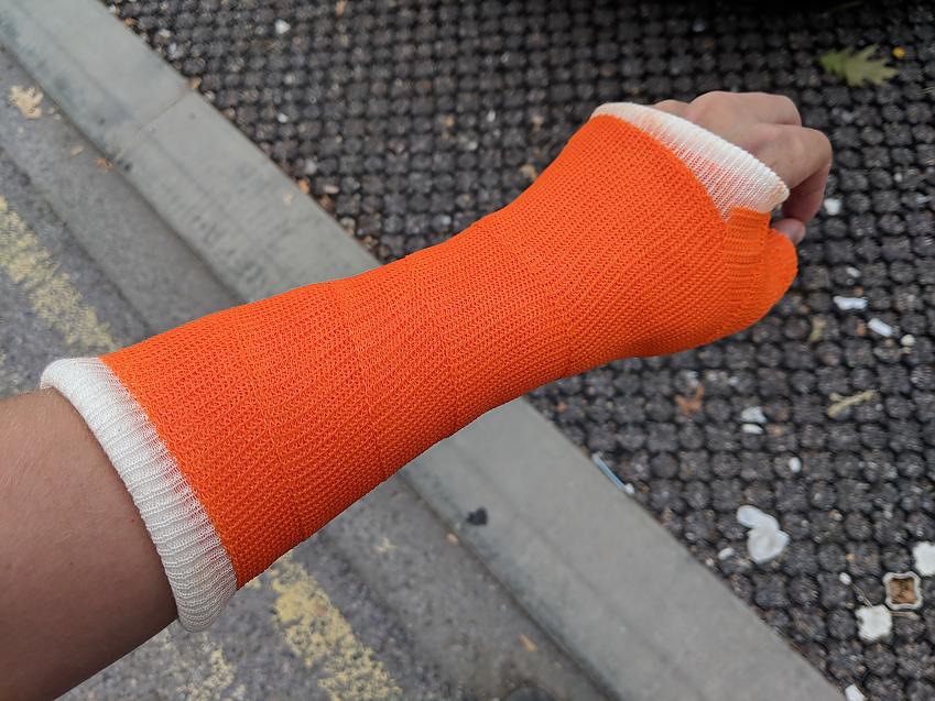 Stephen suffered a fractured wrist after he came off because of a pothole